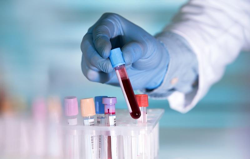 GDP605 automated genomic DNA extraction for tissues, cells, blood, swabs, FFPE and bacteria
